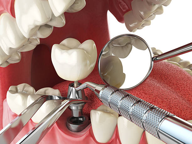 Best Knocked-Out Tooth Emergency  in Marcellus, MI